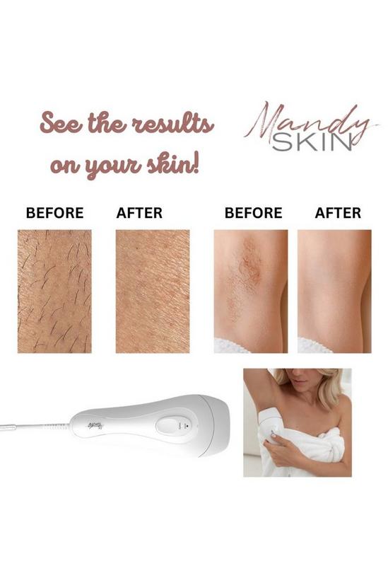 Mandy Skin Handheld IPL Hair Removal Device for Pain Free Hair Care 3